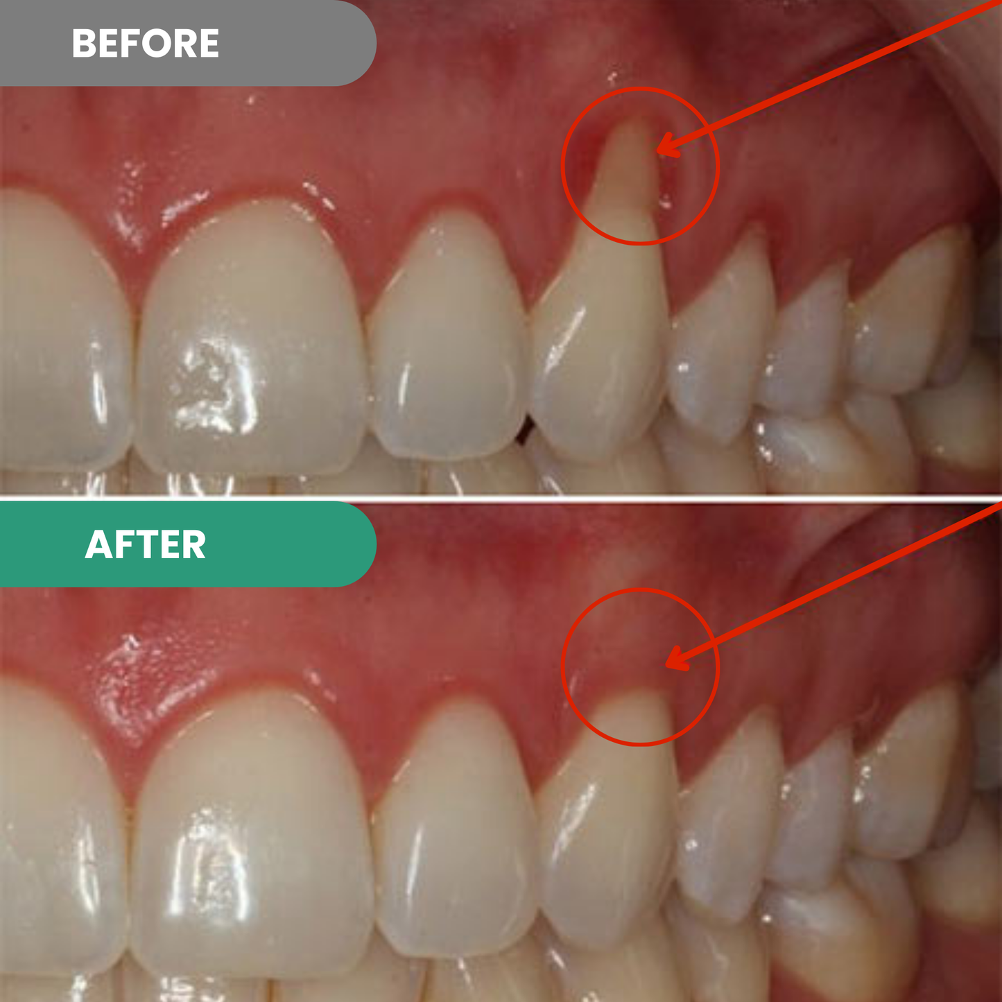 Teeth Repair Gel