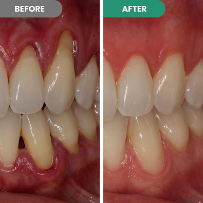 Gum Repair Pen